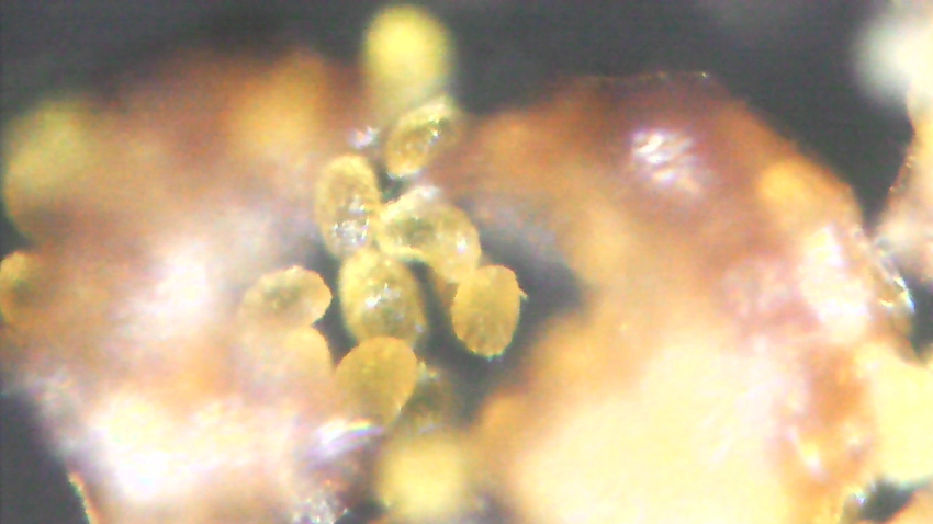 Spores de Polypodium interjectum